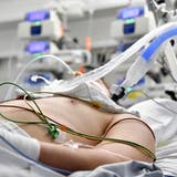 Ein Mann liegt auf der Intensivstation der Salzburger Landeskliniken (SALK). (APA)