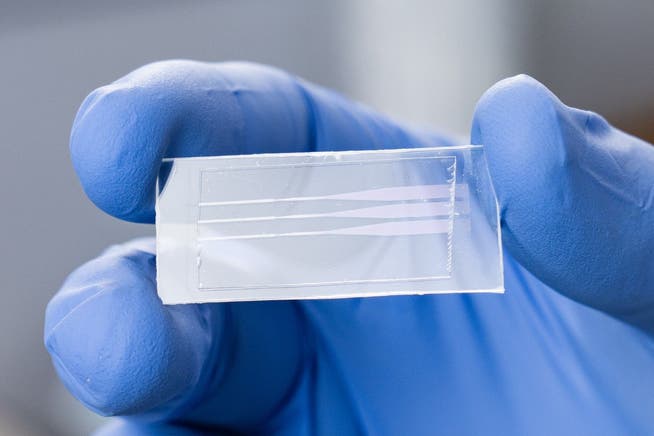 Die Test-Plättchen, mit deren Hilfe Antikörper gegen verschiedene Erreger im Blut erkannt werden.