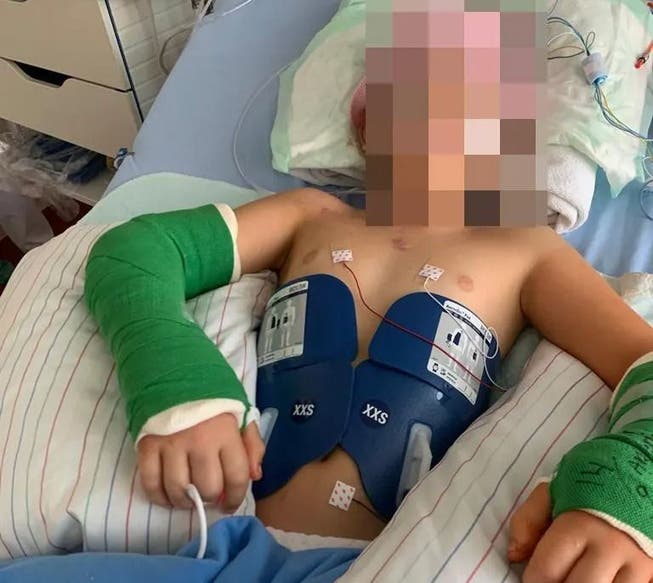 Beim Unfall eines Neunjährigen im Schulhaus Laufenburg 2020 verletzte sich dieser schwer und musste im Spital behandelt werden.