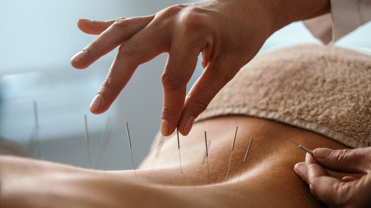 Akupunktur bei Multipler Sklerose? Integralmediziner finden, man müsse besonders chronische Krankheiten ganzheitlicher betrachten. (Getty)