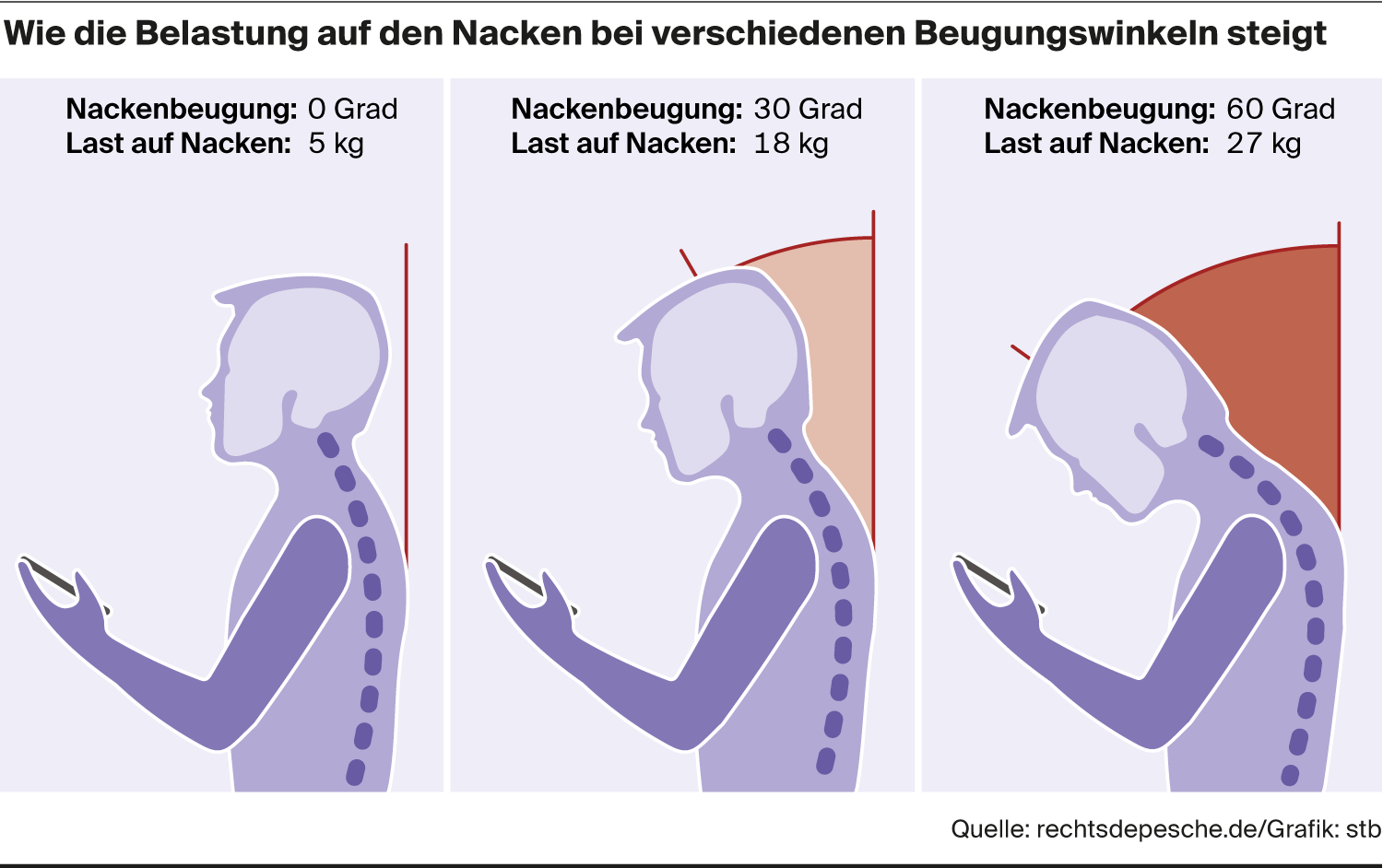 Handynacken: Wie Das Smartphone Unserem Nacken Schadet