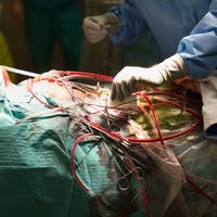«Das ist ihr gutes Recht»: Krankenkassen ziehen wegen St.Galler Herzchirurgie vor Gericht – was Gesundheitschef Bruno Damann dazu sagt